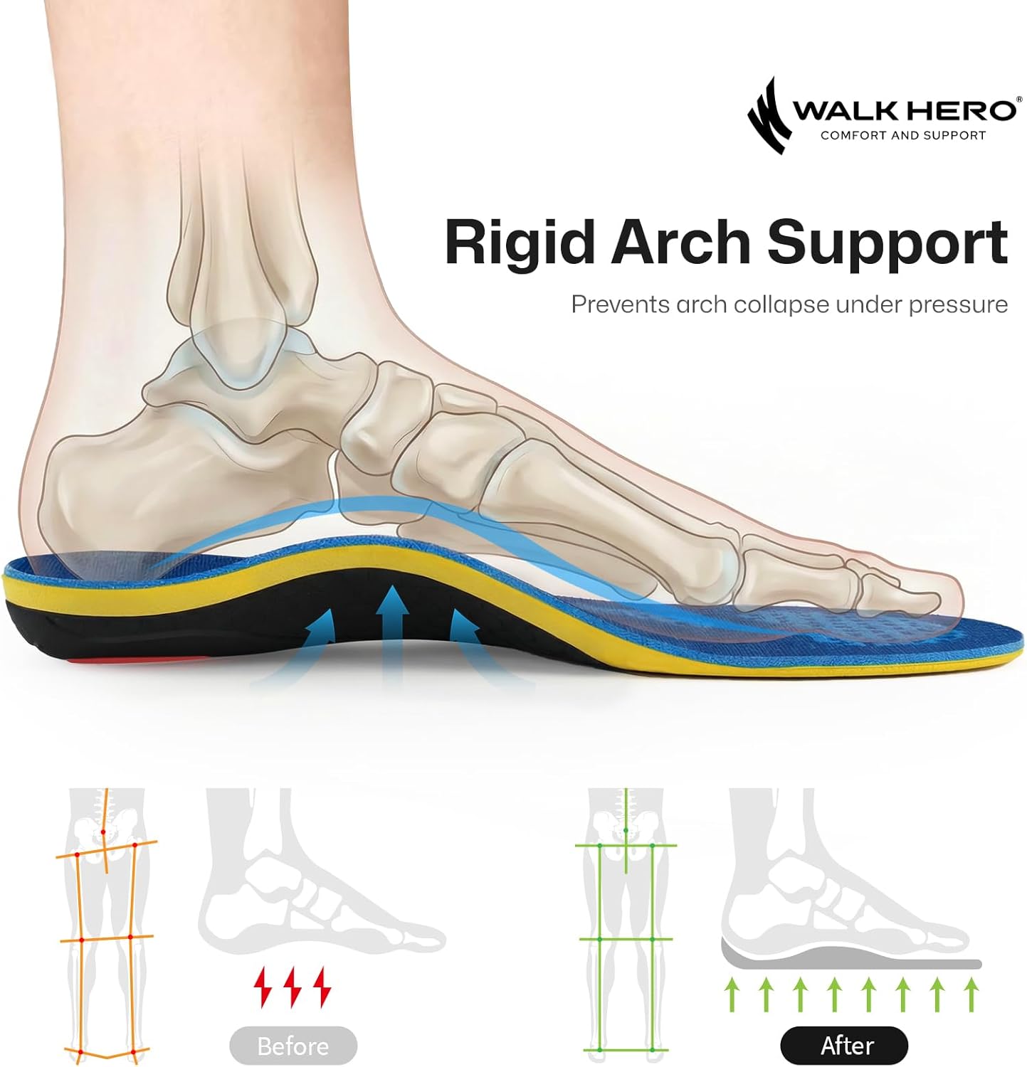 WalkHero Heavy Duty High Arch Support Insoles, 220+lbs High Arch Support Orthotics Inserts for Plantar Fasciitis, Flat Feet, Pronation and Heel Pain (Mens 10-10.5 | Womens 12-12.5, Glacial Blue) - Image 2