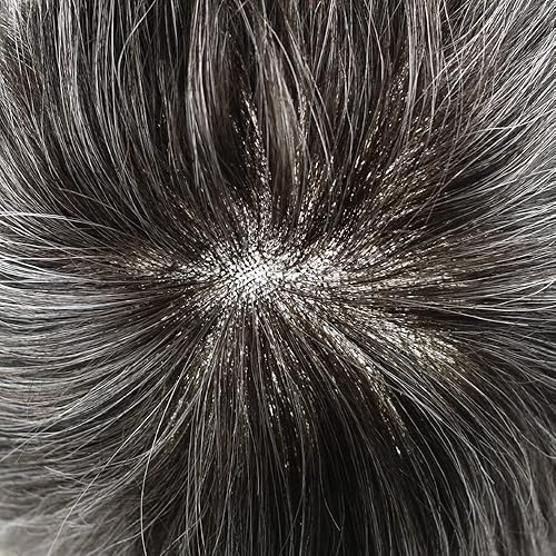 Miniatura 10 de Hair Wonders Extensiones de cabello para hombre y tupés de repuesto para hombre, sistema de cabello fino mono hombre, encaje frontal, cabello humano