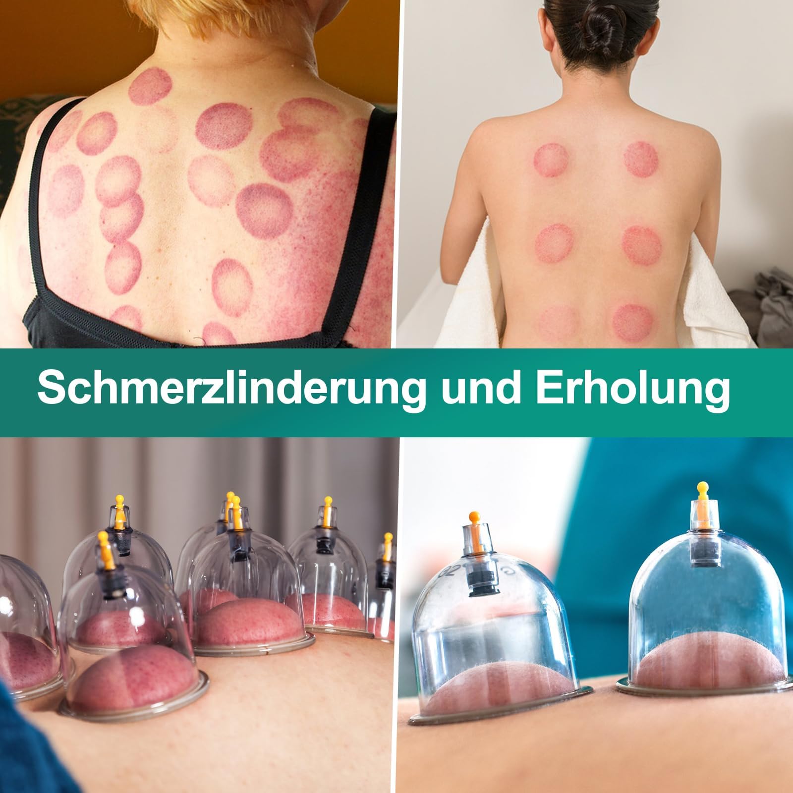 Schröpftherapie Set 22 Tassen, Große Größe V2.0 für Frauen Männer Vakuum Cup für Körper Muskel Rücken Schmerzlinderung Massage Saugen Cellulite Sauggerät Tasche DE-T02