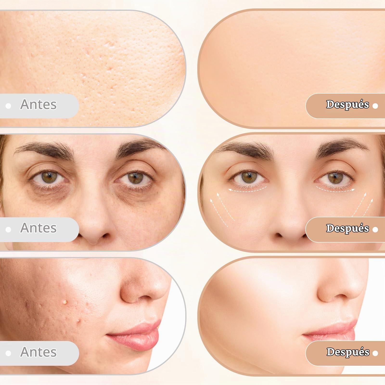 CARER BEAUTY Dispositivo de belleza facial por radiofrecuencia - Masajeador facial antienvejecimiento 5 en 1 utilizado para reafirmar la piel y antienvejecimiento