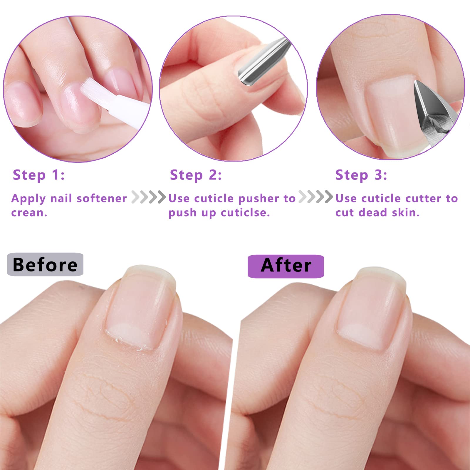 Nagelhautschneider mit Nagelhautschieber und Schere, Nagelhautentferner, professionelle langlebige Pediküre-Maniküre-Werkzeuge, Edelstahl Nagelhautzange Cutter Clipper (rosa Drücker)