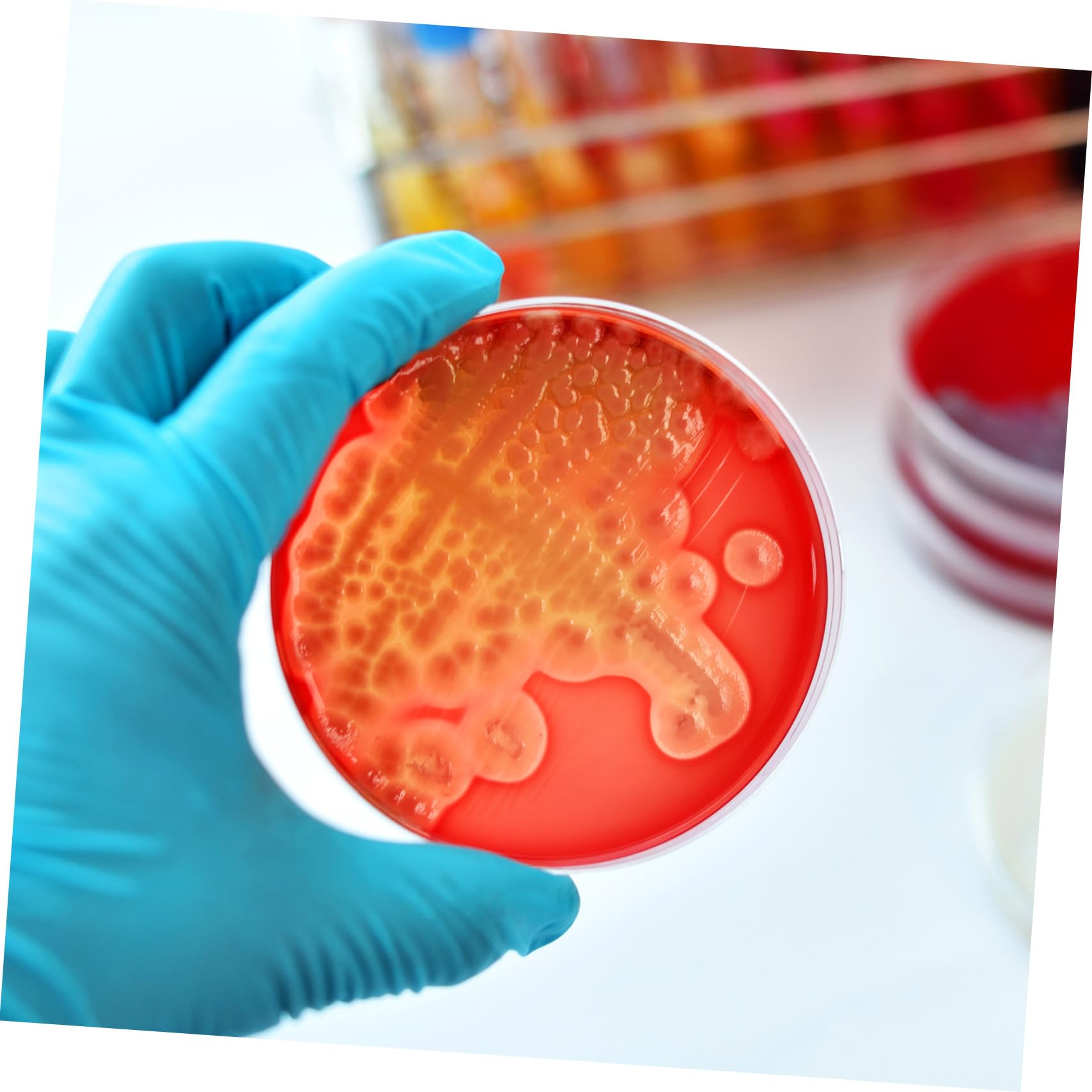 Placas de Agar Prevertido para Cultivo de Tejidos, 20 Piezas