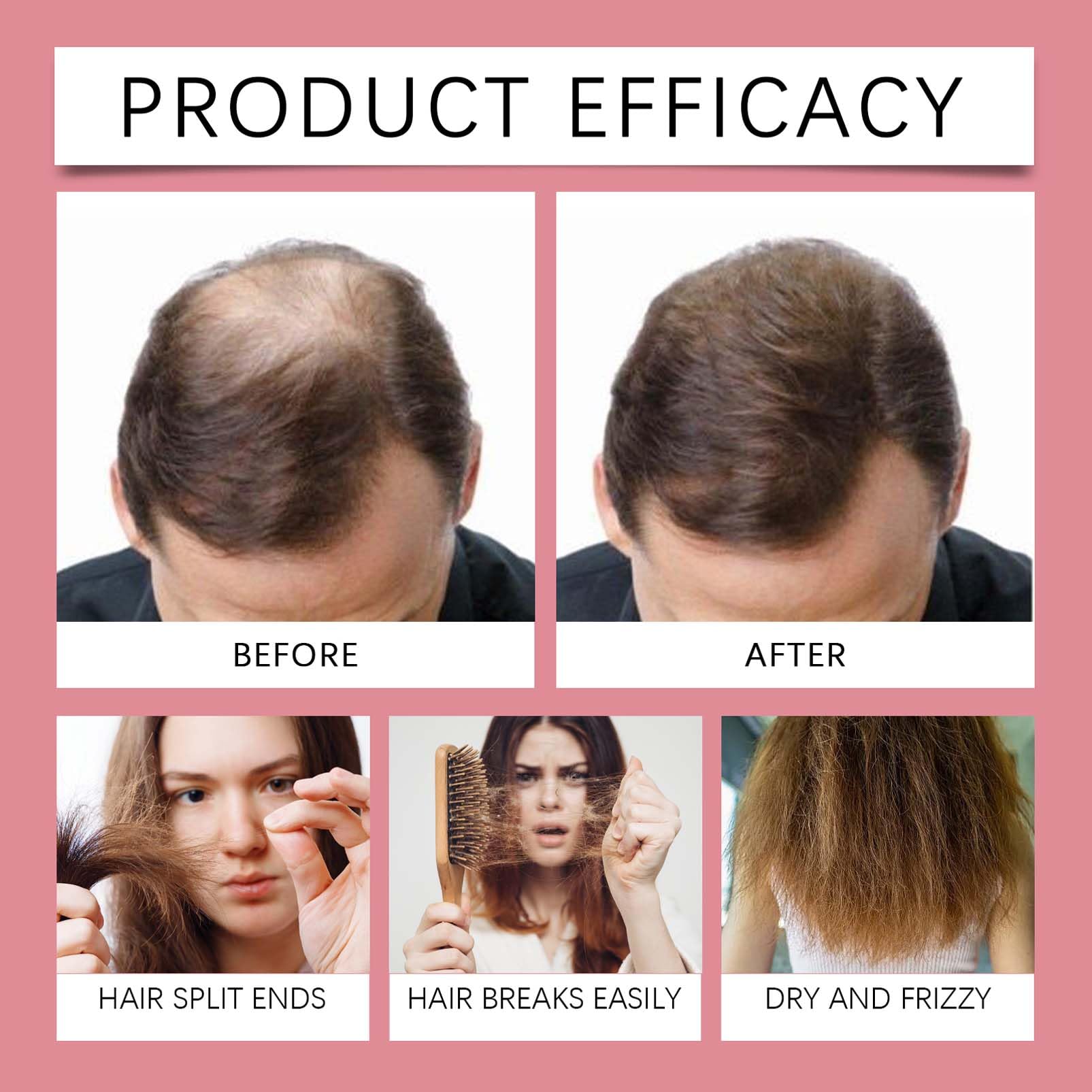 Spray do wzrostu włosów, 50 ml serum na wzrost włosów, Hair Revive Serum do przerzedzających się włosów, objętość włosów, przeciw wypadaniu włosów, pielęgnacja i nawilżanie włosów, grubszy spray na