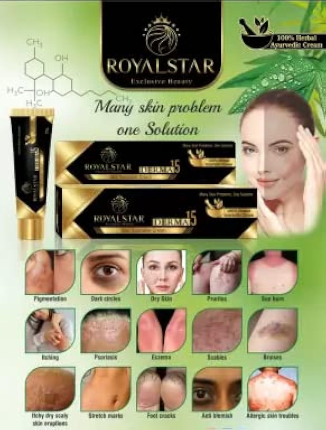 Royalstar Thenyn Royalstar Derma 15 Skin Specialist Cream 25G Dark Circle Remover Herbal Ayurvedic Cream