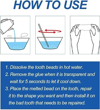 Dental Repair Kit with Moldable False Teeth - Temporary Solution to Replace Missing or Broken Teeth - Includes Repair Beads for Fixing and Filling - Ideal Fake Dental Replacement Kit