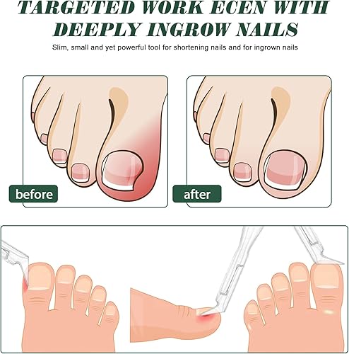 Miniatura 3 de FVION Toenail Clipper Straight Blade, Professional Toe Nail Clipper for Senior, Ingrown Toenail Tool for Thick Ingrown Nails