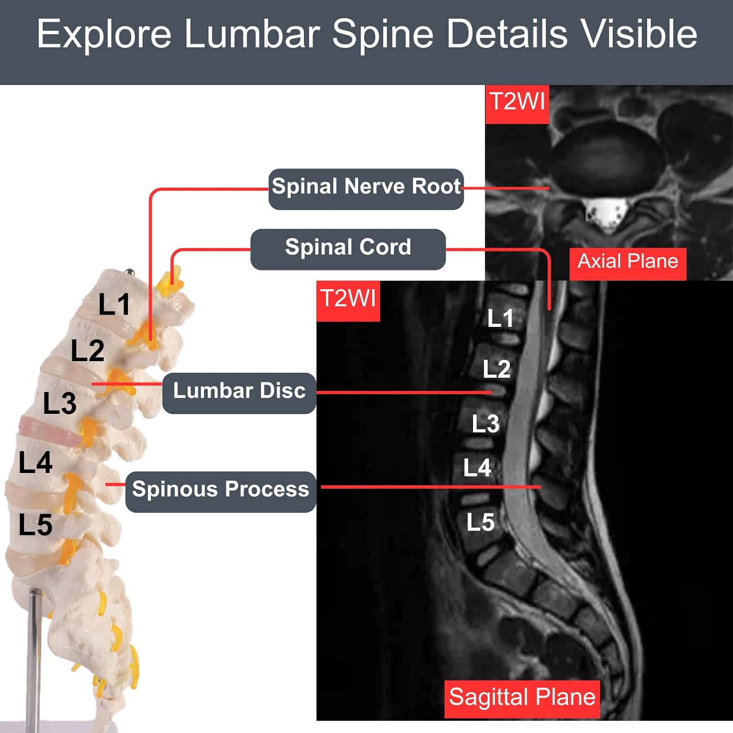 Doctor Verified Lumbar Spine Model - Life Size Human Lumbar Vertebrae Anatomy Model with Sacrum, Coccyx, Intervertebral Disc and Spine Nerves for Medical Learning & Teaching & Demonstrating