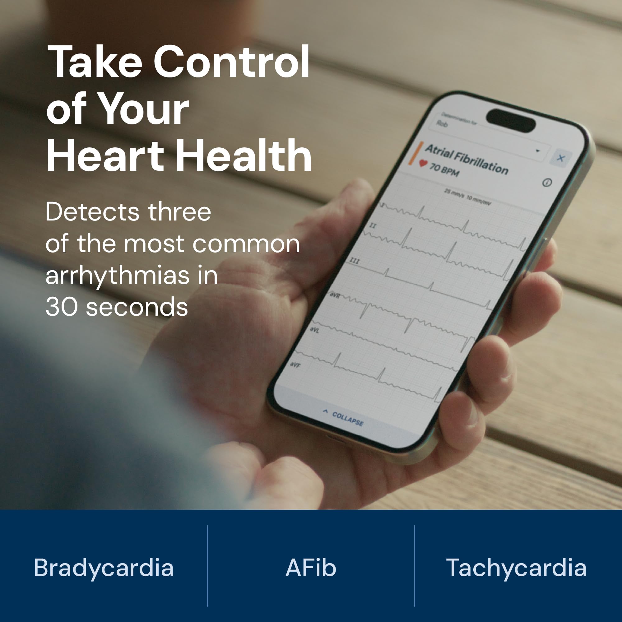 Kardiamobile Electrocardiografo Portatil de 6 derivaciones – Detecta fibrilación Auricular – Resultados instantáneos en 30 Segundos – Funciona con la mayoría de los Smartphones