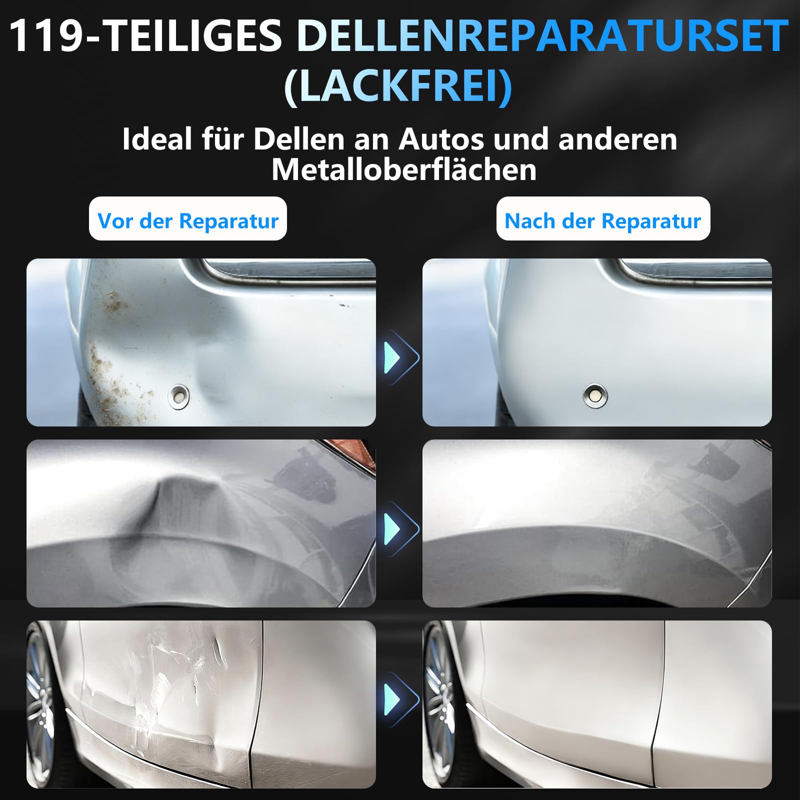 Auto Dellen Reparaturset 119Pcs - Auto Reparatur Ausbeulwerkzeug Lackfreies Dent Reparatur Puller Kit Karosserie Beulen Ausbeulwerkzeugset für Hagelschaden Fahrzeug Dellen