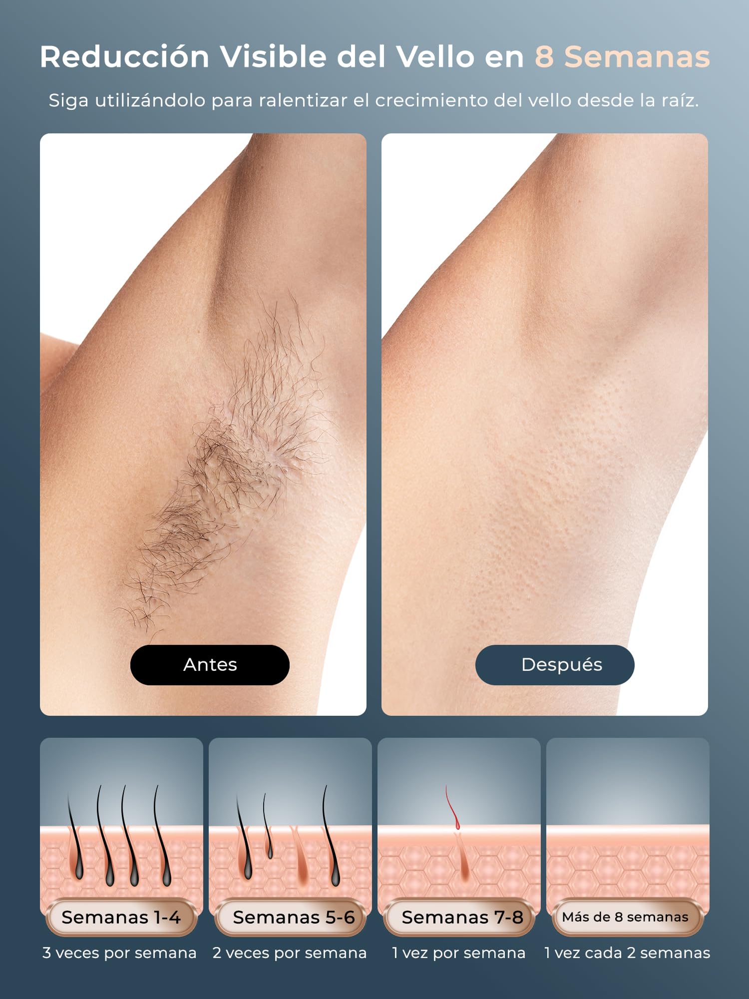 21J Depiladora Laser con Función de Refrigeración, 600-1200NM Depiladora Luz Pulsada con 9 Niveles de Energía, Pantalla Táctil LCD para Mujer y Hombre, Bikini, Axilas, Cara, Cuerpo Blanco