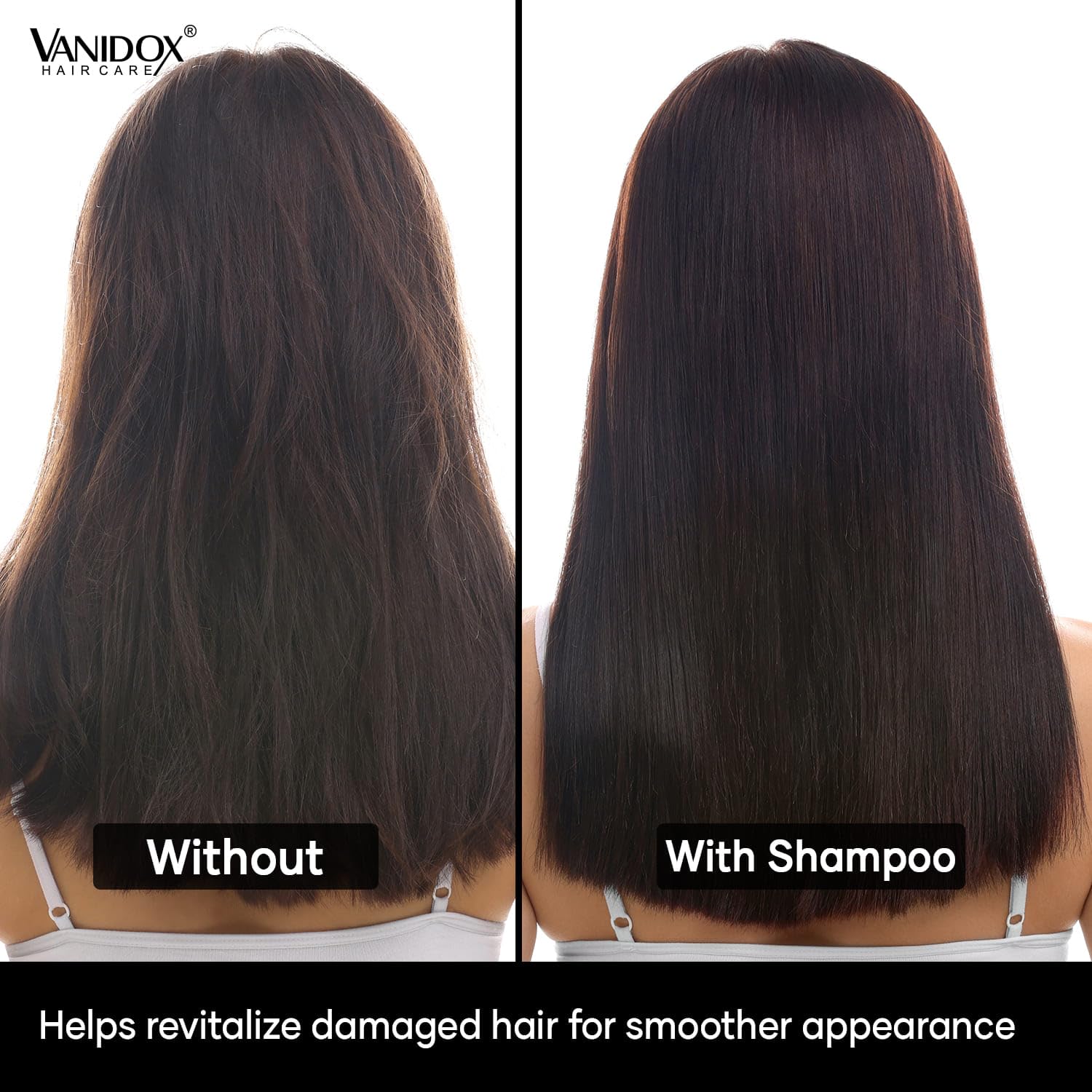 VANIDOX ReFortix Korean Shampoo and Conditioner Set, Enriched with Ginseng, Green Tea, and Camellia Oil, Supports Growth Stage and Helps Reduce Hair Loss for Stronger Hair (16 fl oz each)