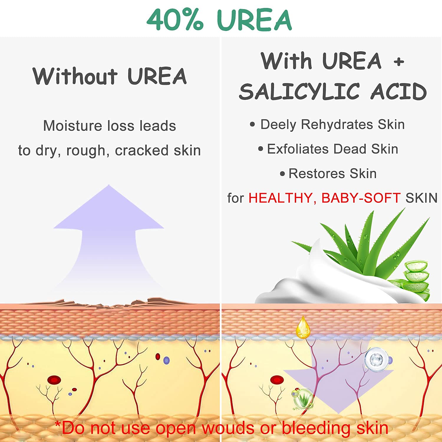 Crema de urea 40 por ciento para pies, crema para pies, 40% loción de urea para piel seca/talones agrietados/pies ultra callosos, suaviza la piel áspera en los pies, cuidado de la piel con glicerina, 3