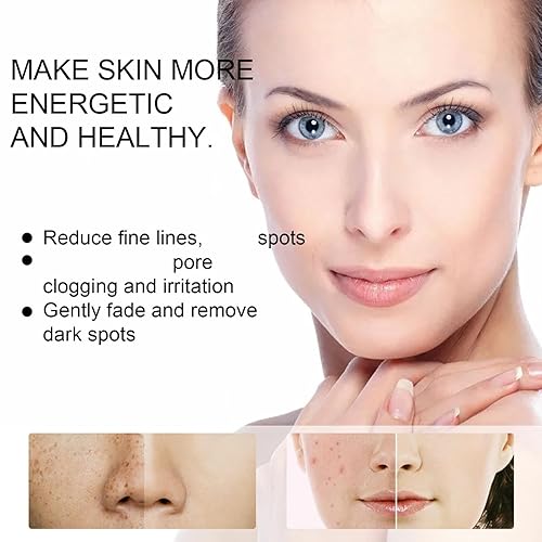 Miniatura 5 de Crema para manchas oscuras en la cara, cremas para Quitar Manchas de La Cara, crema para Las Manchas de La Cara, crema para limpiar la cara Elimina