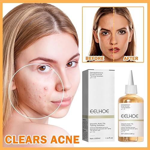 Miniatura 2 de Solución de rejuvenecimiento tonificante de ácido glicólico de 3.4 fl oz, exfoliación facial de poros de ácido glicólico al 7 %, rejuvenece tu piel,