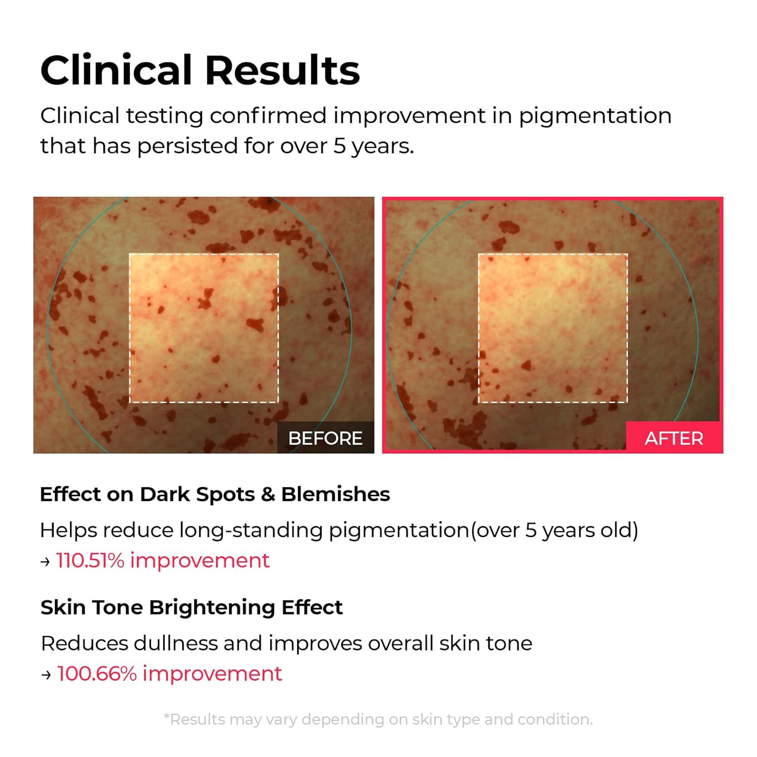 Dr.Melaxin TX Astaxanthin Triple Jelly Serum – TXA, Astaxanthin & Niacinamide Face Serum for Even Skin Tone, Radiance & Hydration - Image 2