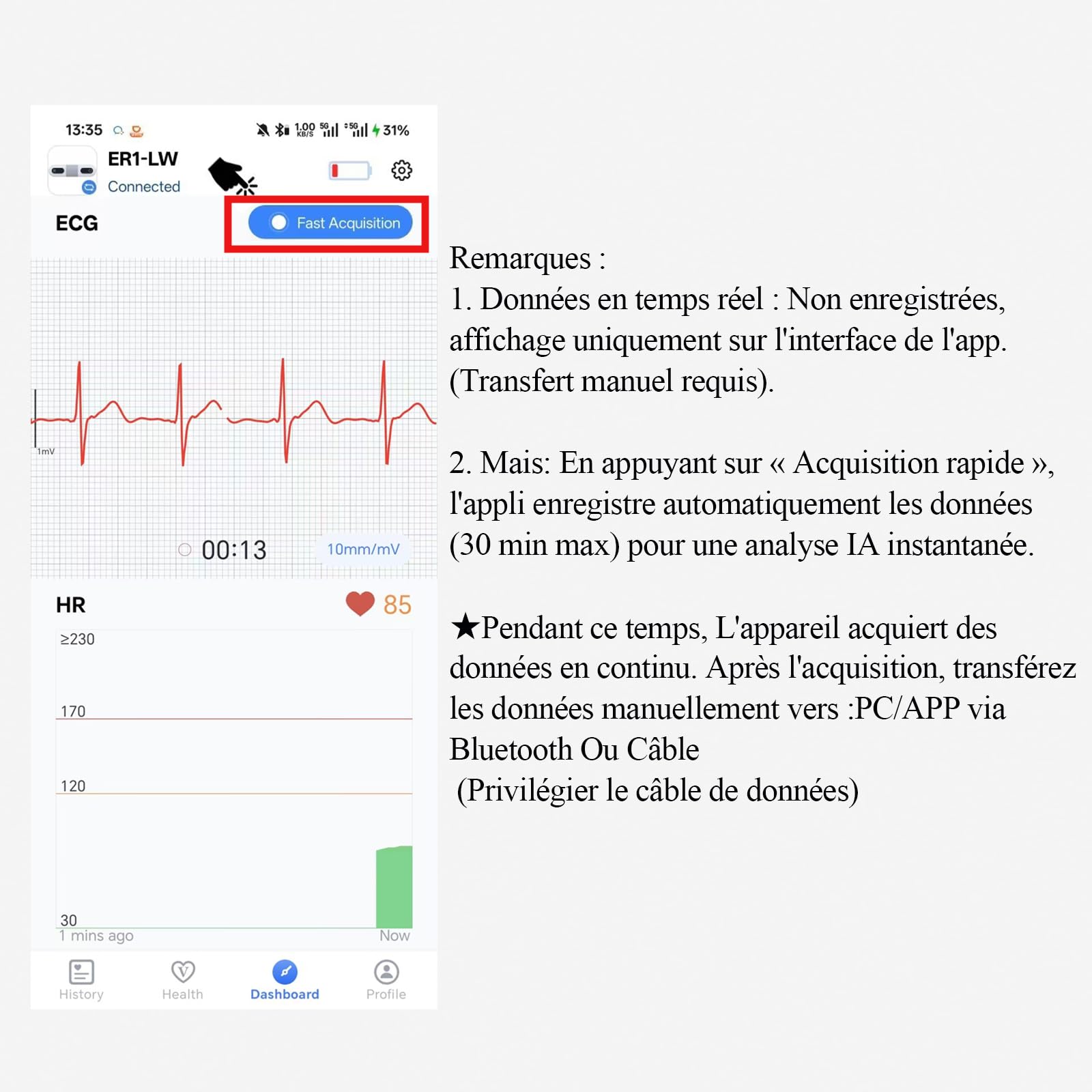 CheckMe ER1-LW Moniteur ECG Portable 72 Heures avec Analyse ECG AI, Fonction Marqueur D'événement ECG, App & PC-software, Compatible avec Les Électrodes à pression de 4 mm