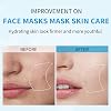 Mascarilla Facial de Ácido Hialurónico IREV, Cuidado de la Piel, Mascarilla Hidratante para el Rostro, Mascarilla de Tela de Hidratación Profunda, Mascarilla Facial para Todo Tipo de Piel, Mascarilla Post-Solar, Mascarillas Hidratantes, Paquete de 10 para Piel Sensible, 10 Unidades (Paquete de 1) 7