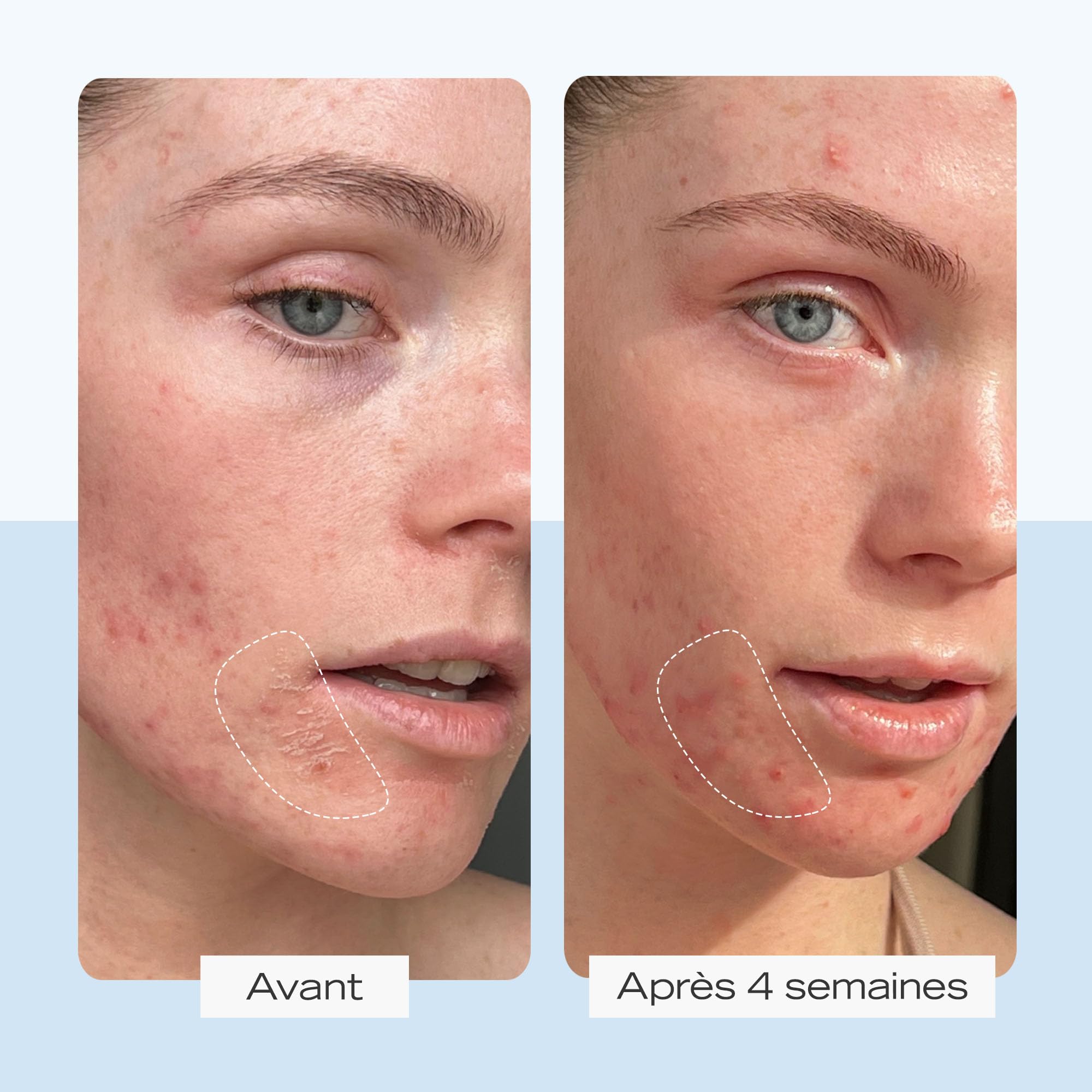 First Aid Beauty FAB, Ultra Repair Cream, Crème Ultra Réparatrice, Crème Hydratante Intensive pour Visage et Corps (170 g), Protège et Restaure la Peau Grasse ou Sensible