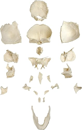 Parco Scientific PB00157 Cráneo de plástico totalmente desarticulado de 22 partes