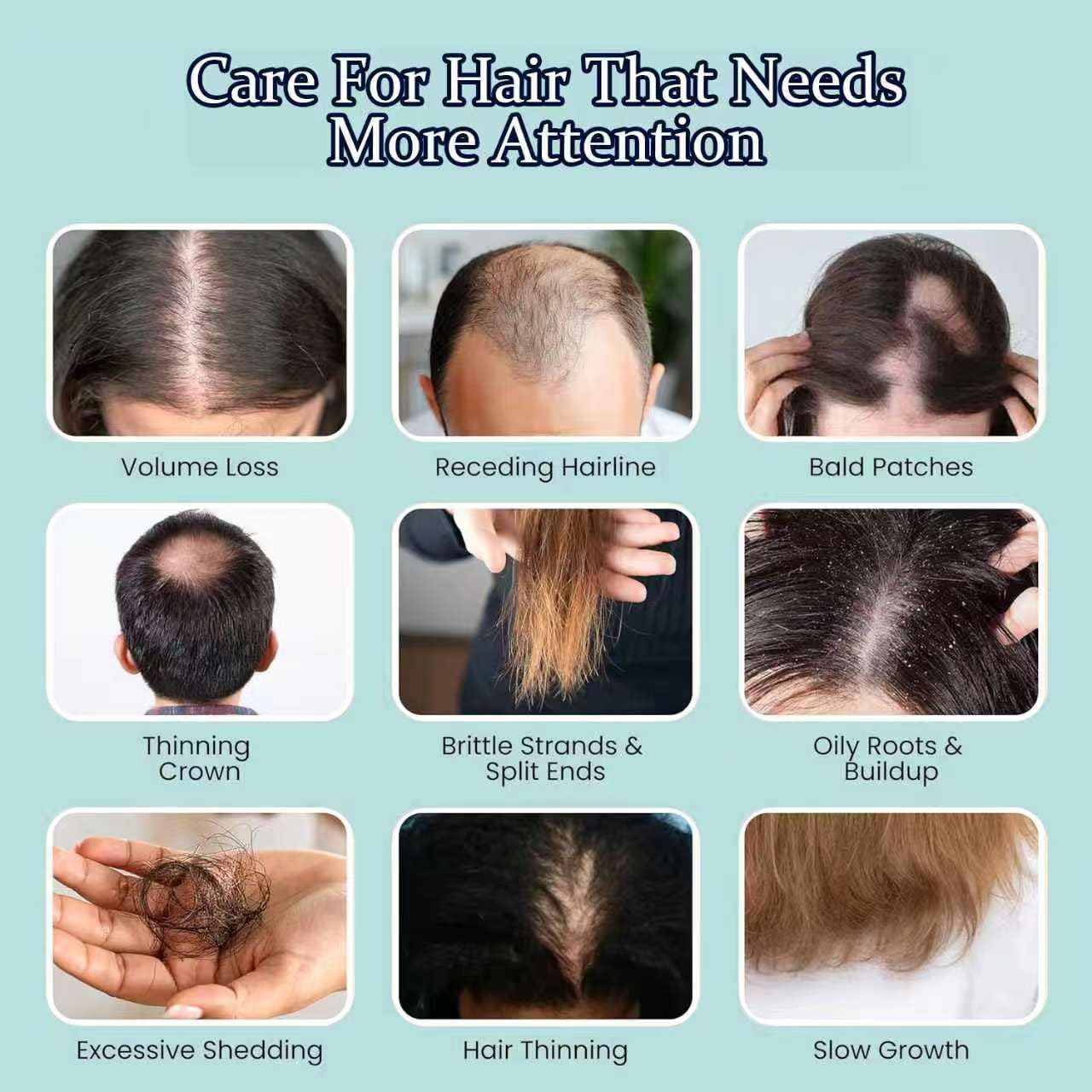 7-in-1 Red Light Scalp Massager Brush Vibrating Electric Scalp Massager with LED Light Modes & Serum Applicator, Cordless Waterproof Hair Care Tool for Head Spa, Scalp Massage (White)