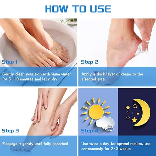 Miniatura 6 de Crema de urea 40 por ciento para pies de máxima fuerza + 2% ácido salicílico, exfoliante de la piel muerta y suaviza el pie agrietado para piel