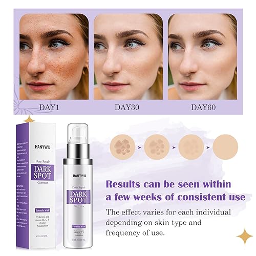 Miniatura 6 de HANYWIL Eliminador de manchas oscuras para suero facial y corporal, crema reparadora rápida del tono con tratamiento de hiperpigmentación, manchas