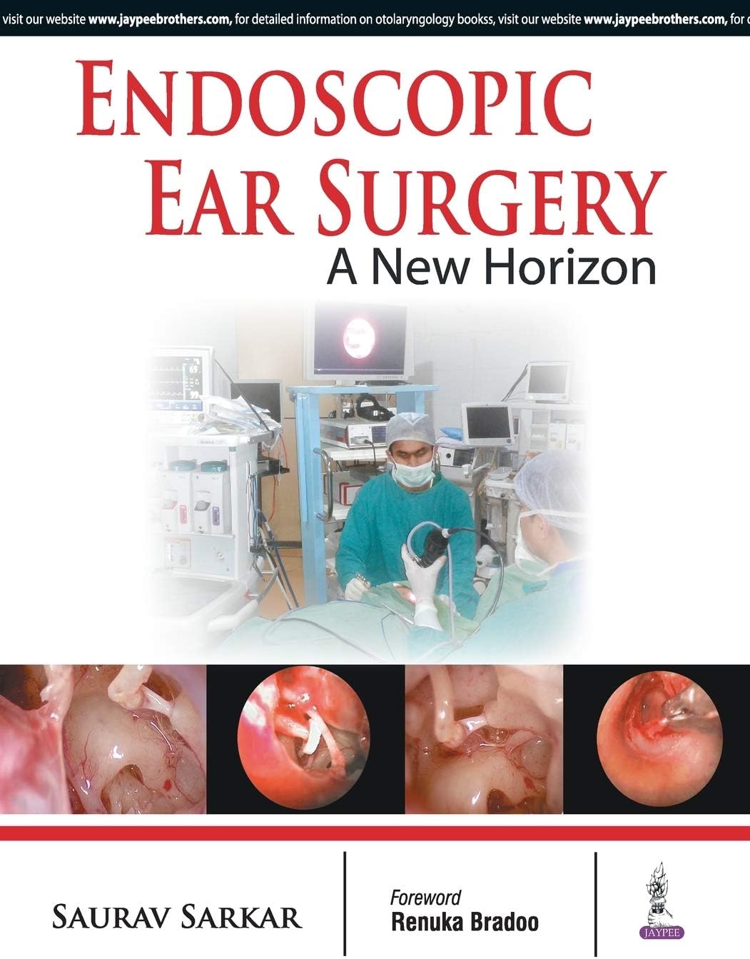 Endoscopic Ear Surgery: A New Horizon