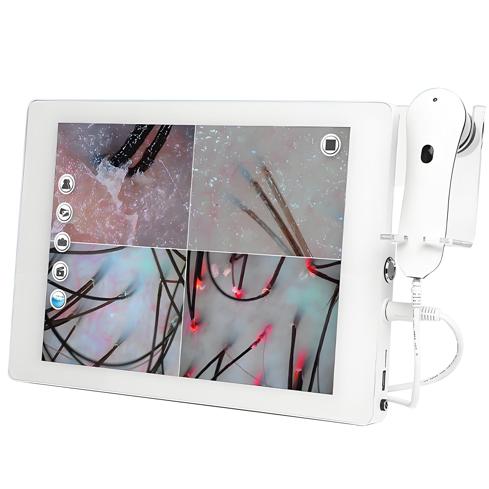 Détecteur de cuir chevelu HD 200X avec écran 15 pouces et double objectif multispectre