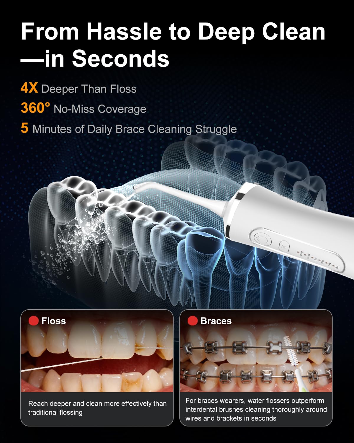 MySmile LP211 - Idropulsore senza fili per denti, 5 modalità, irrigatore orale portatile, 260 ml, per la pulizia dei denti sensibili, idrofilo interdentale ricaricabile da viaggio IPX7 e 2 salviette