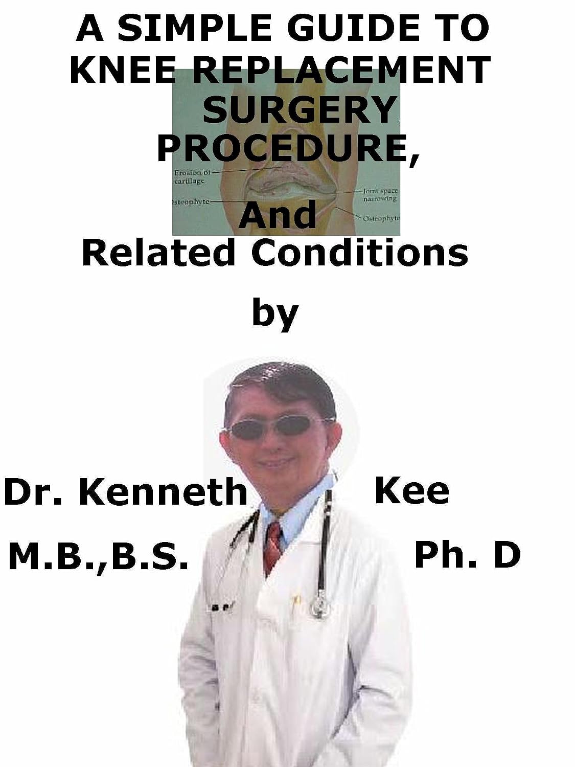 A Simple Guide To Knee Replacement Surgery, Procedure And Related ...
