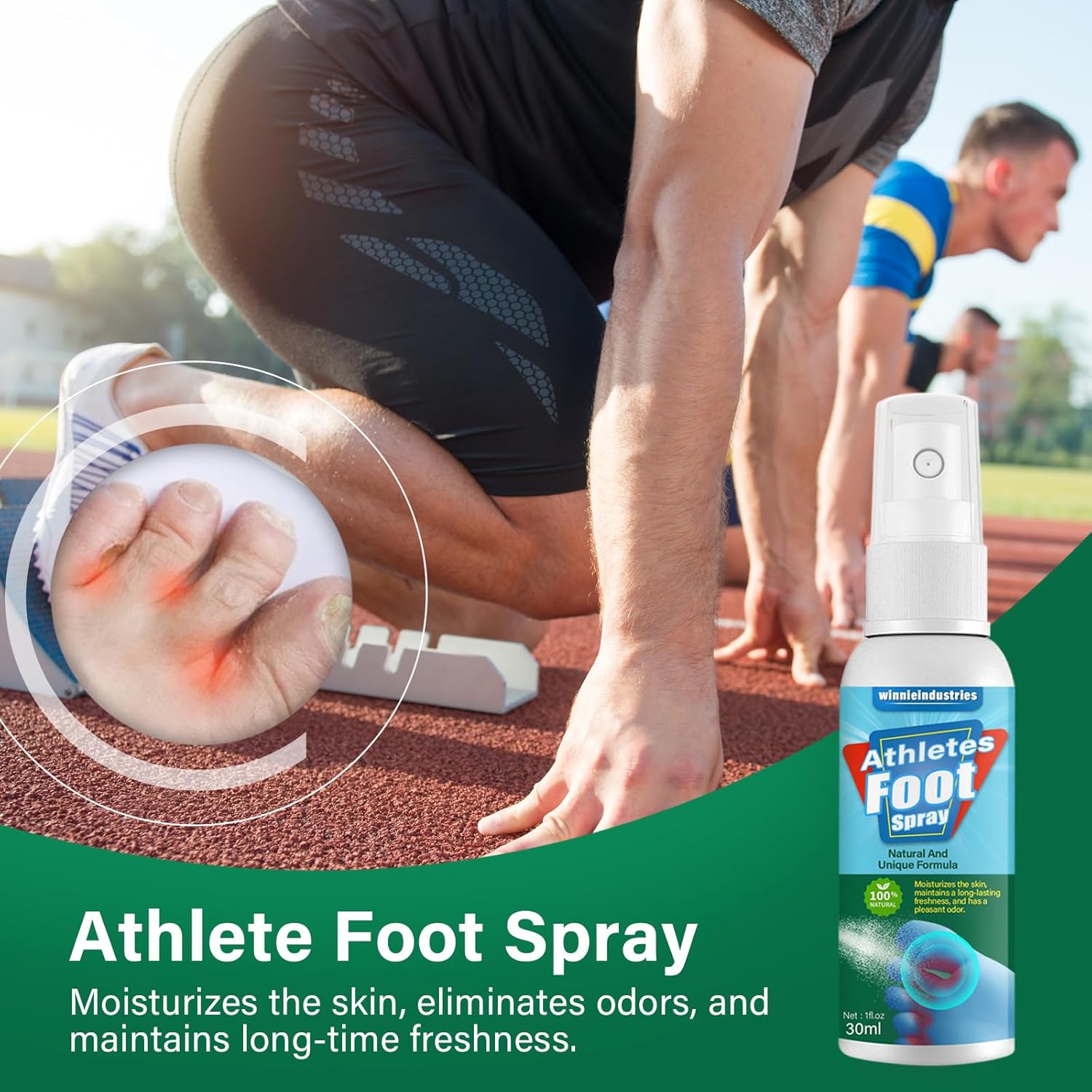 Spray de tratamiento de pies de atletas, ingredientes naturales en