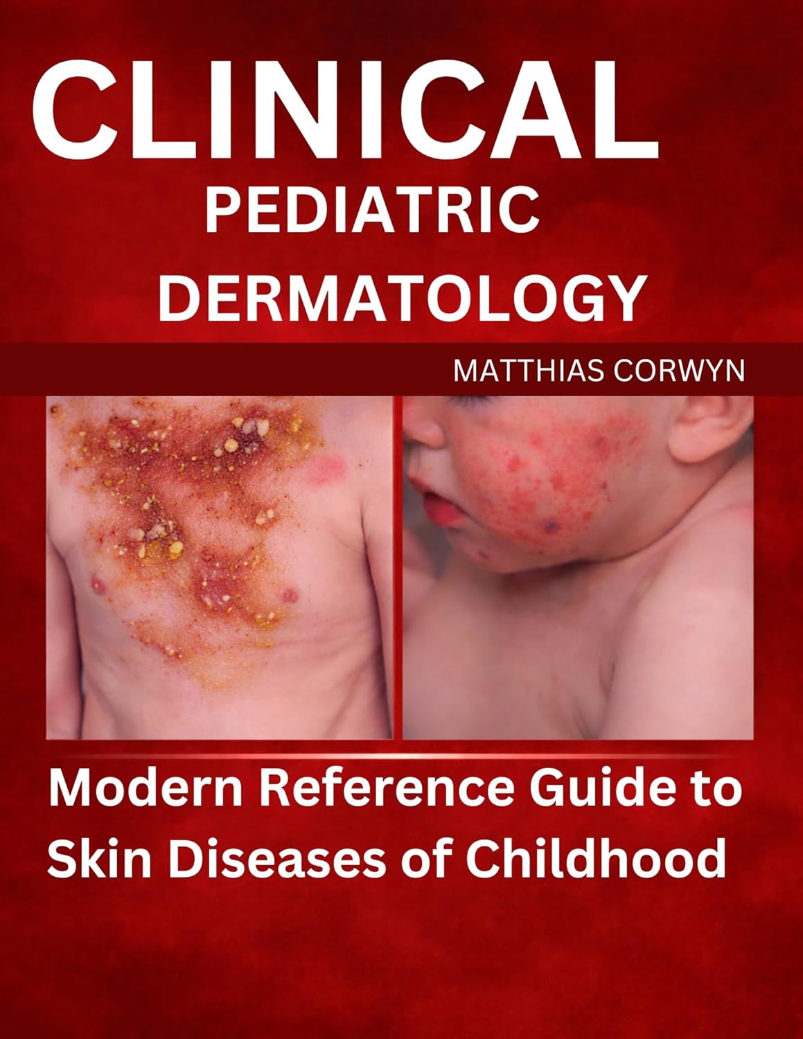 CLINICAL PEDIATRIC DERMATOLOGY: Modern Reference Guide to Skin Diseases of Childhood      [Print Replica] Kindle Edition