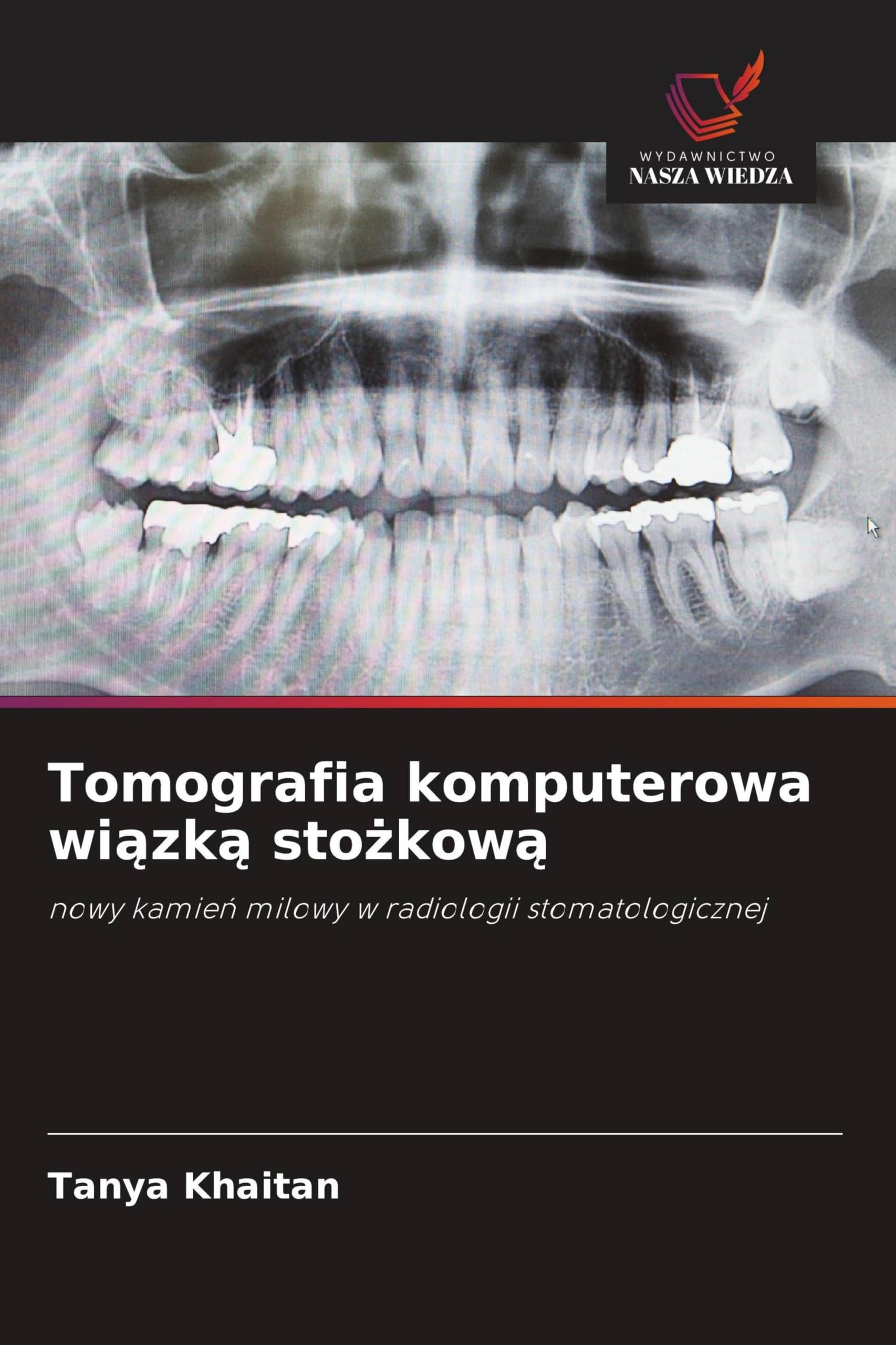 Tomografia komputerowa wi¿zk¿ sto¿kow¿: nowy kamie¿ milowy w radiologii stomatologicznej