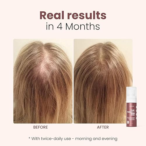 Miniatura 5 de Trybello Hair Helper + Spray  Suero para el crecimiento del cabello, alimentado por Capixyl, con biotina, aceite de ricino, cafeína, agua de arroz y