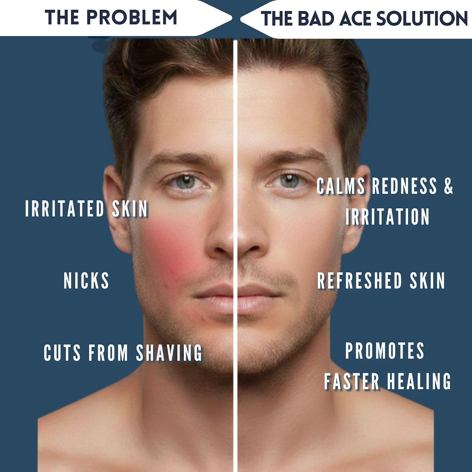 BAD ACE AQua After Shave Balm for Men | Korean Skin Care, Postshave Cream & After Shave lotion for Men, Calms and Soothes Redness, Irritation & Razor Burn | Jeju Ocean Scent, 3 oz