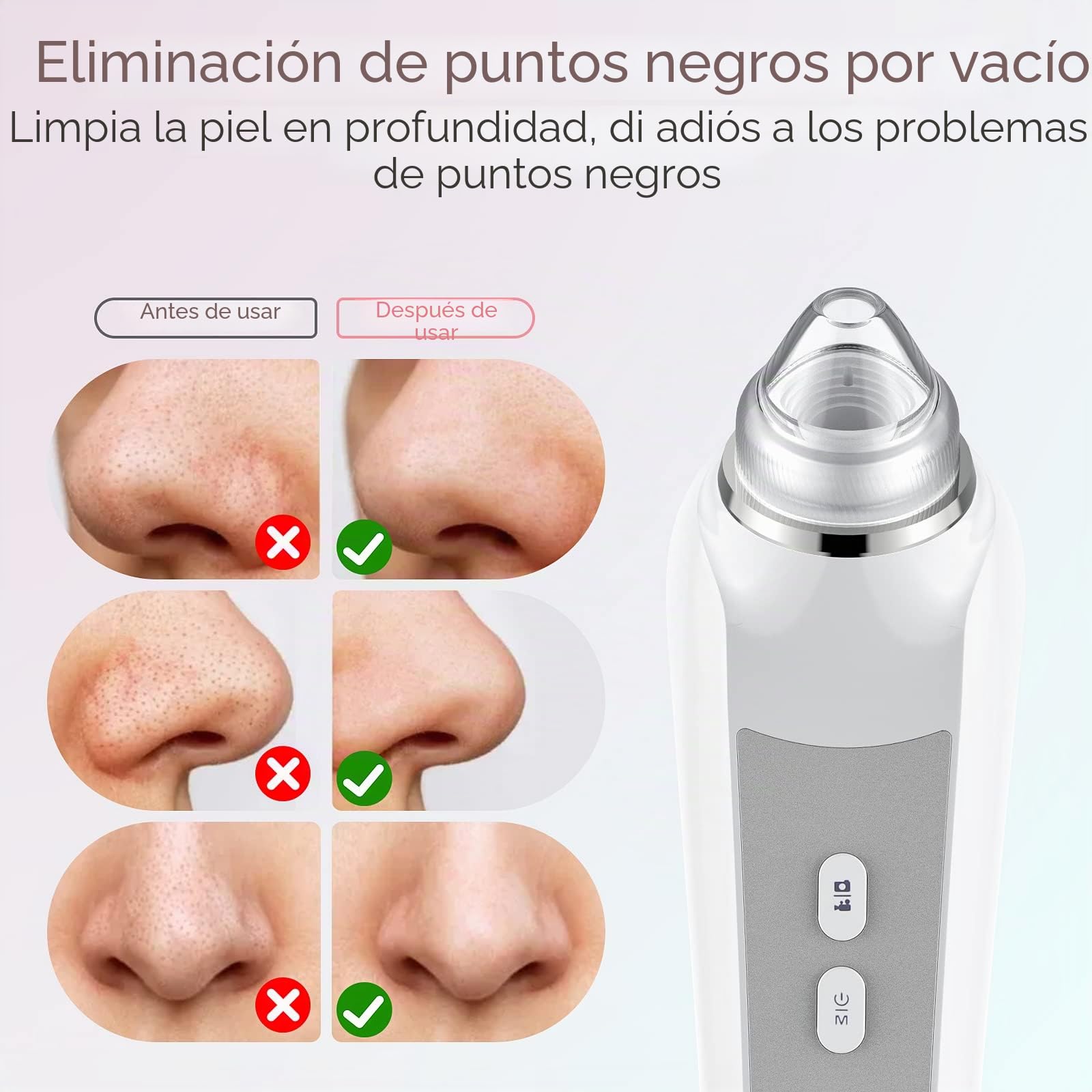 Aspiradora removedora de puntos negros, removedor de cabeza negra para cara con cámara, aspiradora de poros para hombres y mujeres, herramientas de eliminación de puntos negros, 6 cabezales de succión