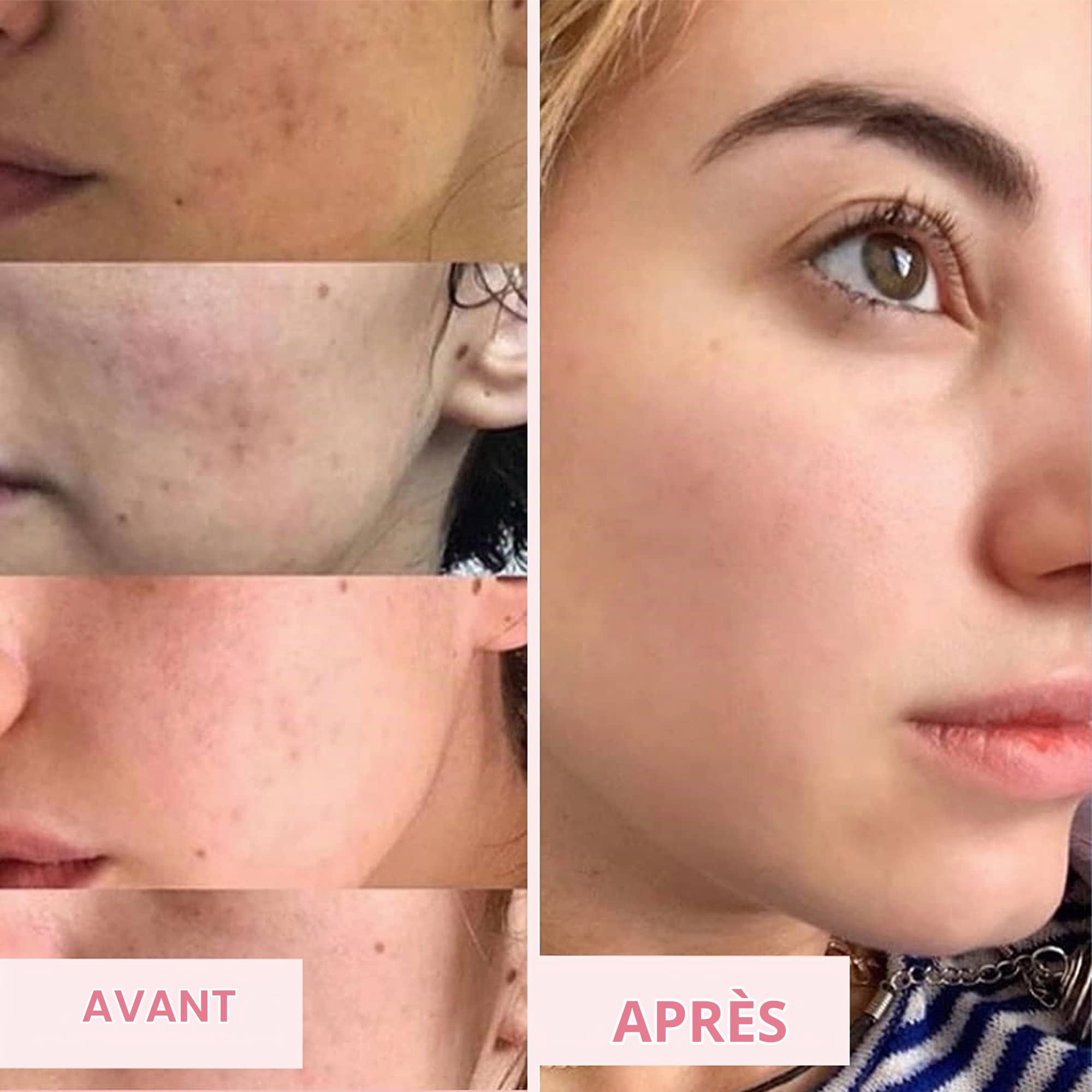Sand & Sky Masque Visage Porefining à l'argile rose australienne Soin de la peau| Minimiseur de pores et nettoyant pour pores avec applicateur de brosse pour masque facial