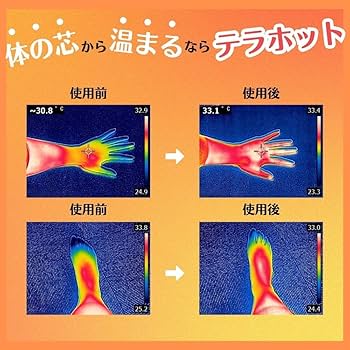 遠赤外線温熱サポーター ホットパック　ケイシー療法　 AC電源 遠赤外線温熱サポーター ホットパック ケイシー療法 AC電源 冷え
