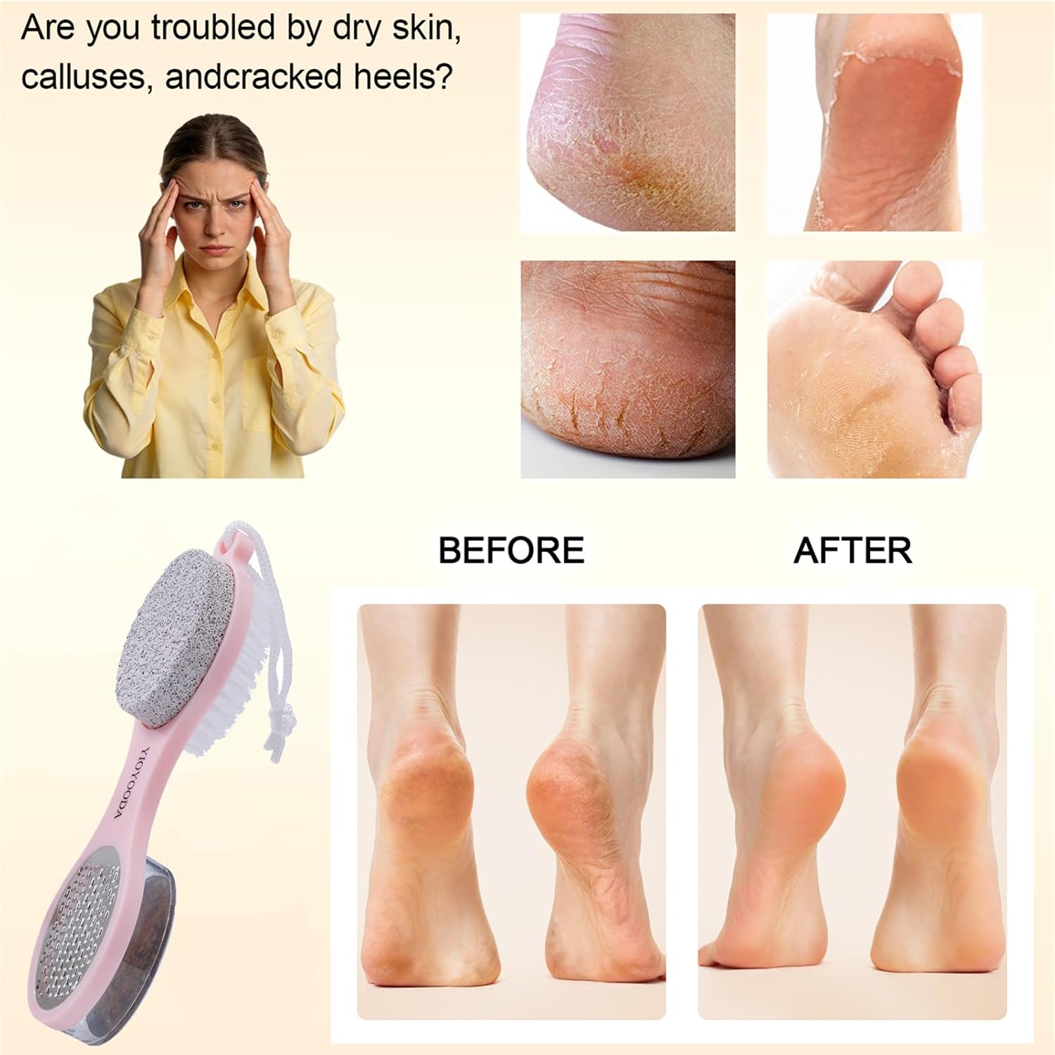 Foot Scrubber Brush with Pumice Stone for Feet, 5-in-1 Foot File Callus Remover, Stainless Steel Feet Scraper, Cleaning Brush and Sand Paper Debris Catcher, Multi Purpose for Home Foot Care