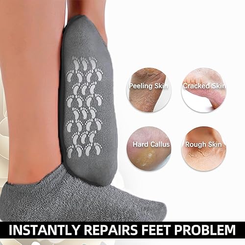 Miniatura 2 de ZFYOUNG Calcetines hidratantes, 2 pares de calcetines de gel hidratante, calcetines suaves para spa y pedicura para talones secos agrietados,