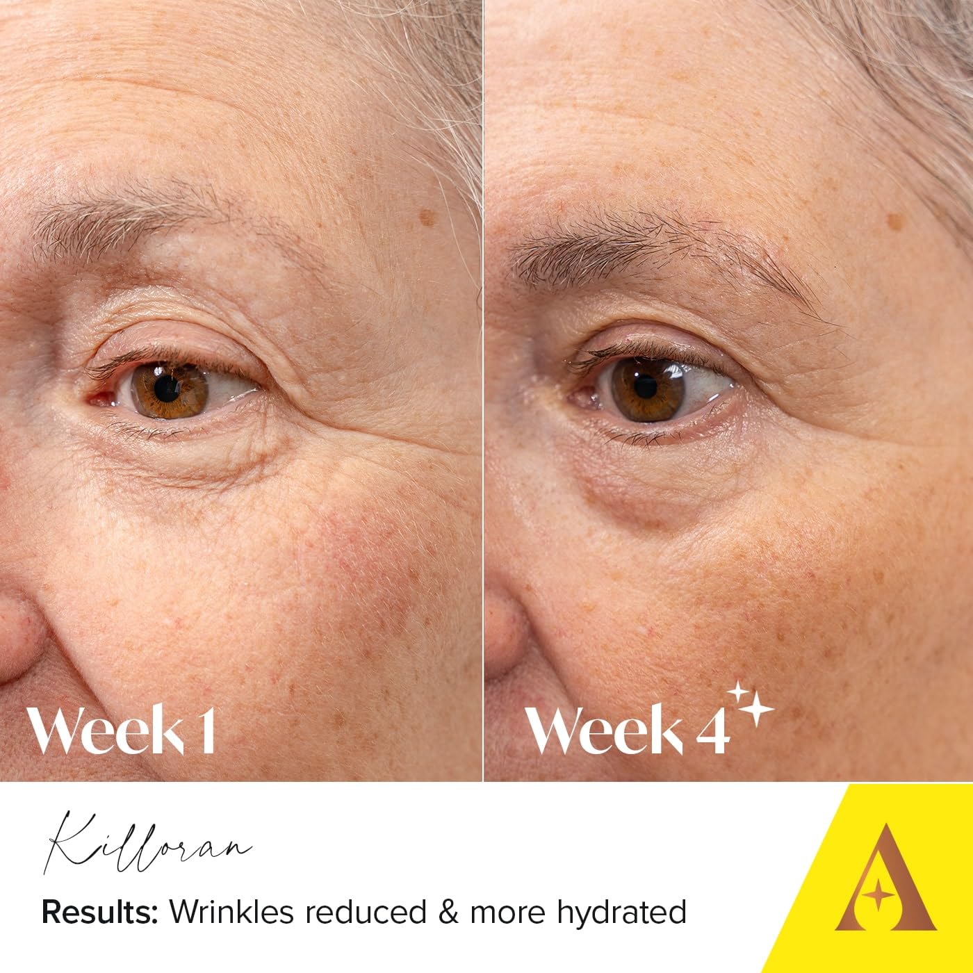 Absolute Collagen Deep Lift Eye Cream 15ml, Radiance Boosting, De-Puff and Brighten Dark Circles - Image 4