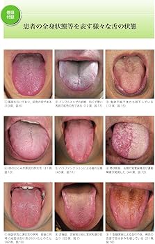 Amazon.co.jp: 舌の診かた: 舌の状態から全身疾患や体の歪みに気づく