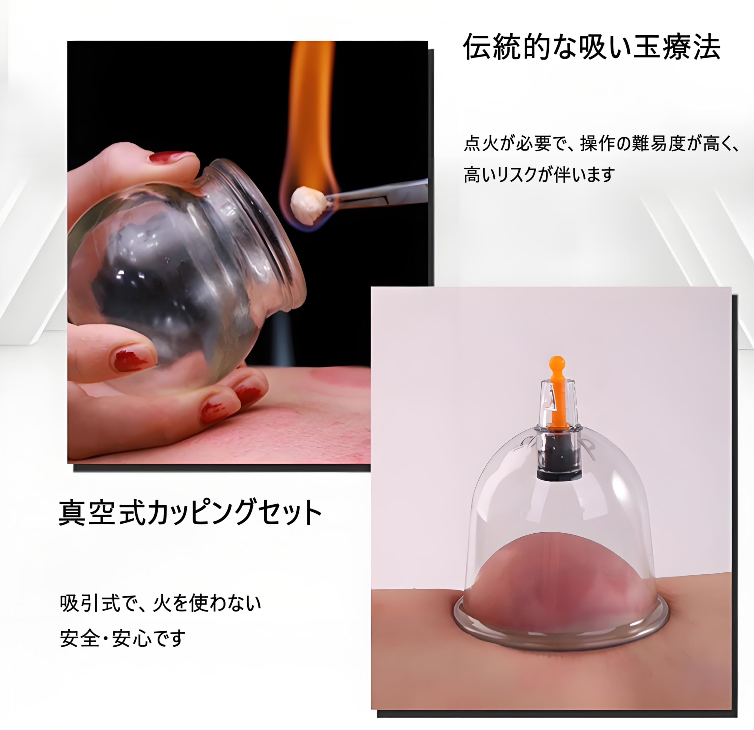Amazon.co.jp: KPPK カッピング ポンプ式手動カッピングセット 吸い玉