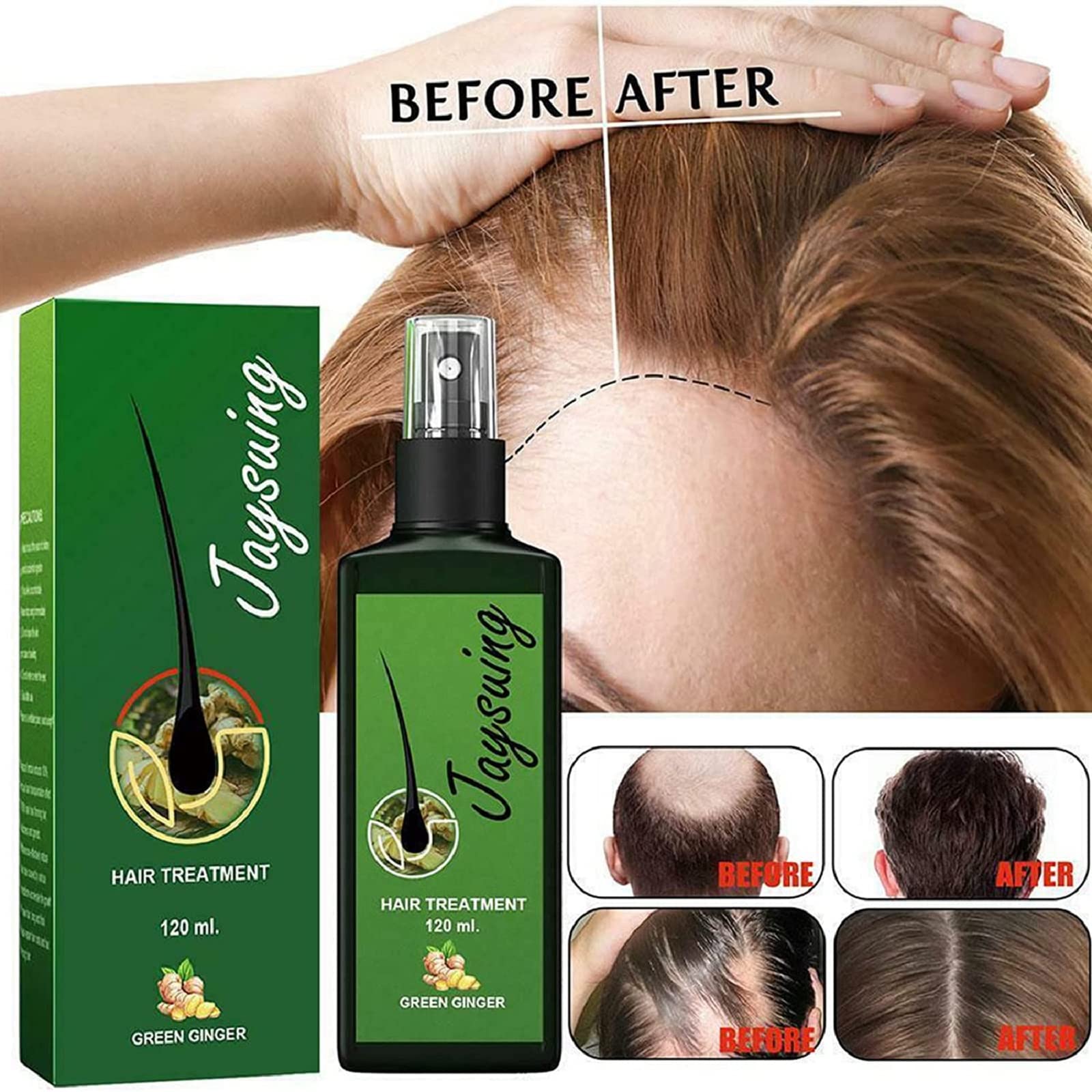 Buy Hair Growth Serum Hair Lotion for Men Women, Growthplus Nourishing