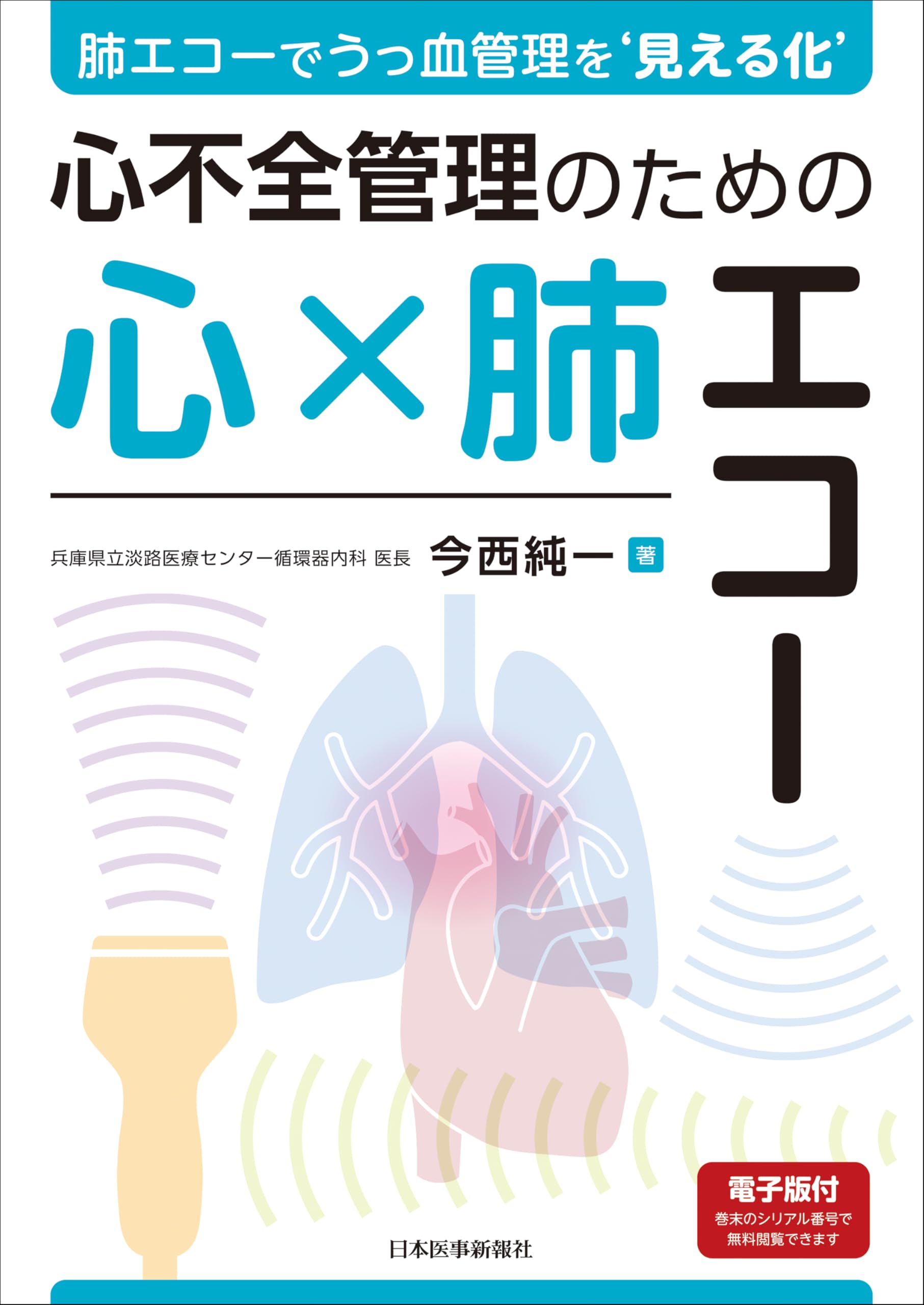 肺エコーでうっ血管理を'見える化' 心不全管理のための心×肺