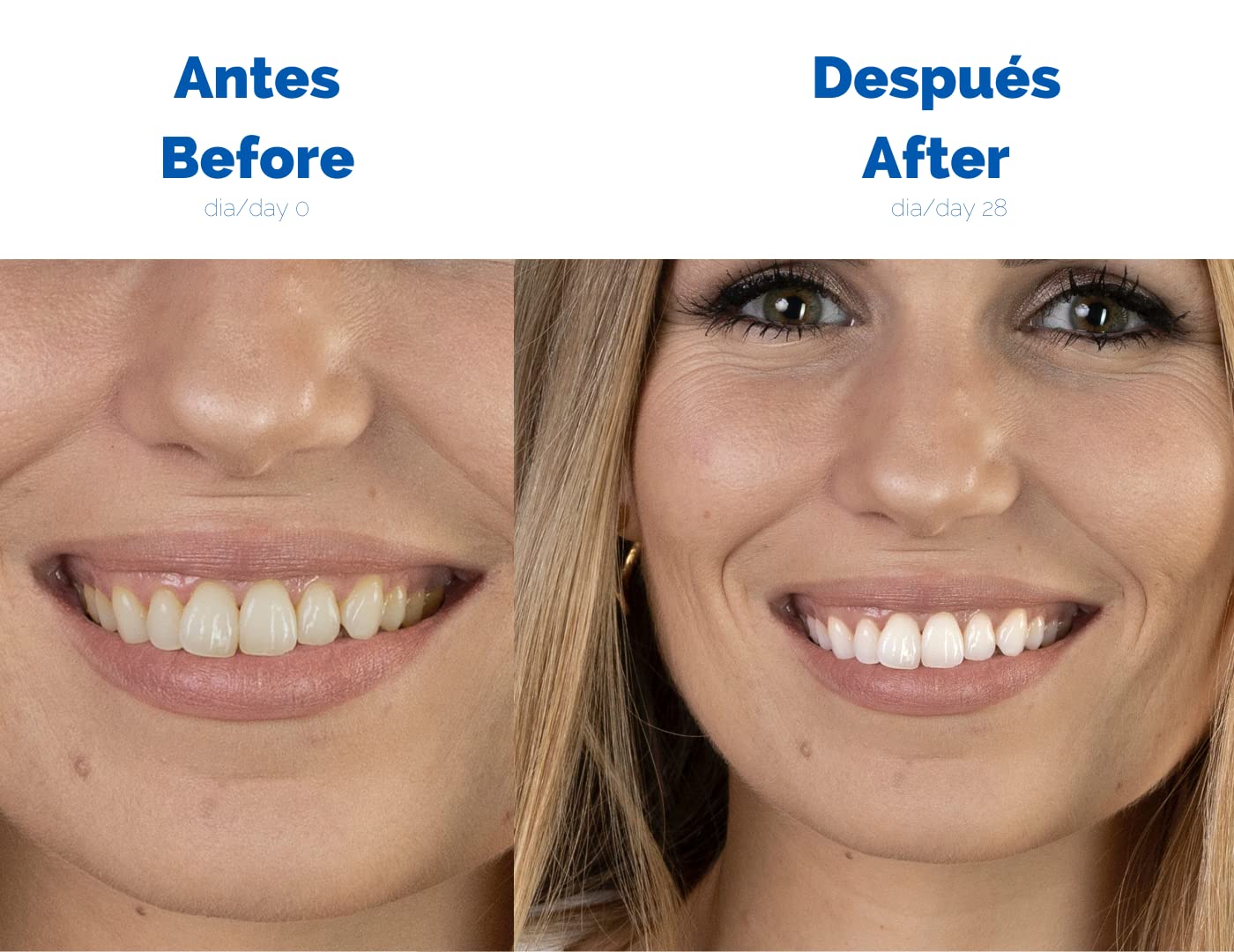 Tiras blanqueadoras de dientes DR INUK ®- 28 tiras sin peróxido ni ácidos para 14 sesiones de blanqueamiento – Fabricado en España - 6 tonos en 4 semanas - Fórmula no sensible