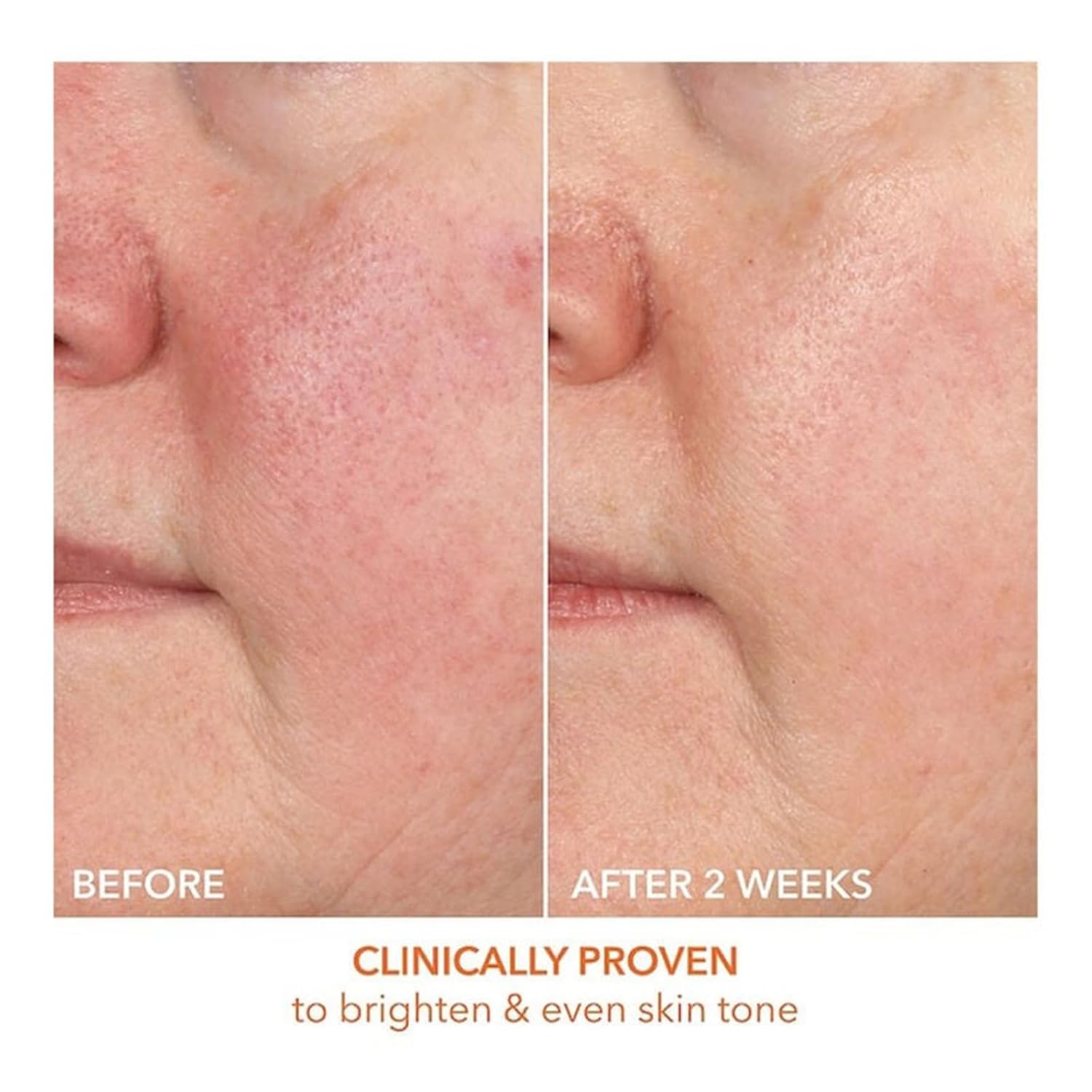 Dr Dennis Gross Vitamin C Lactic 15% Firm & Brighten Serum - Image 6