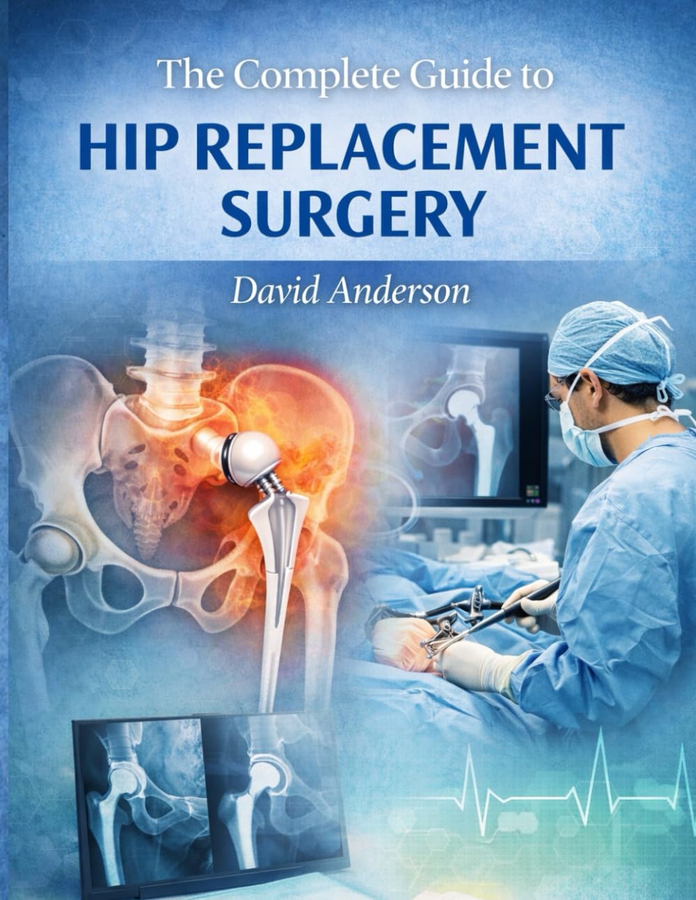 The Complete Guide to Hip Replacement Surgery: WHAT TO EXPECT BEFORE, DURING AND AFTER HIP REPLACEMENT