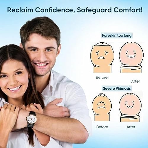 Miniatura 4 de Biancat BruteCo - Gel corrector de prepucio redundante, gel corrector de prepucio redundante profesional (paquete de 1)