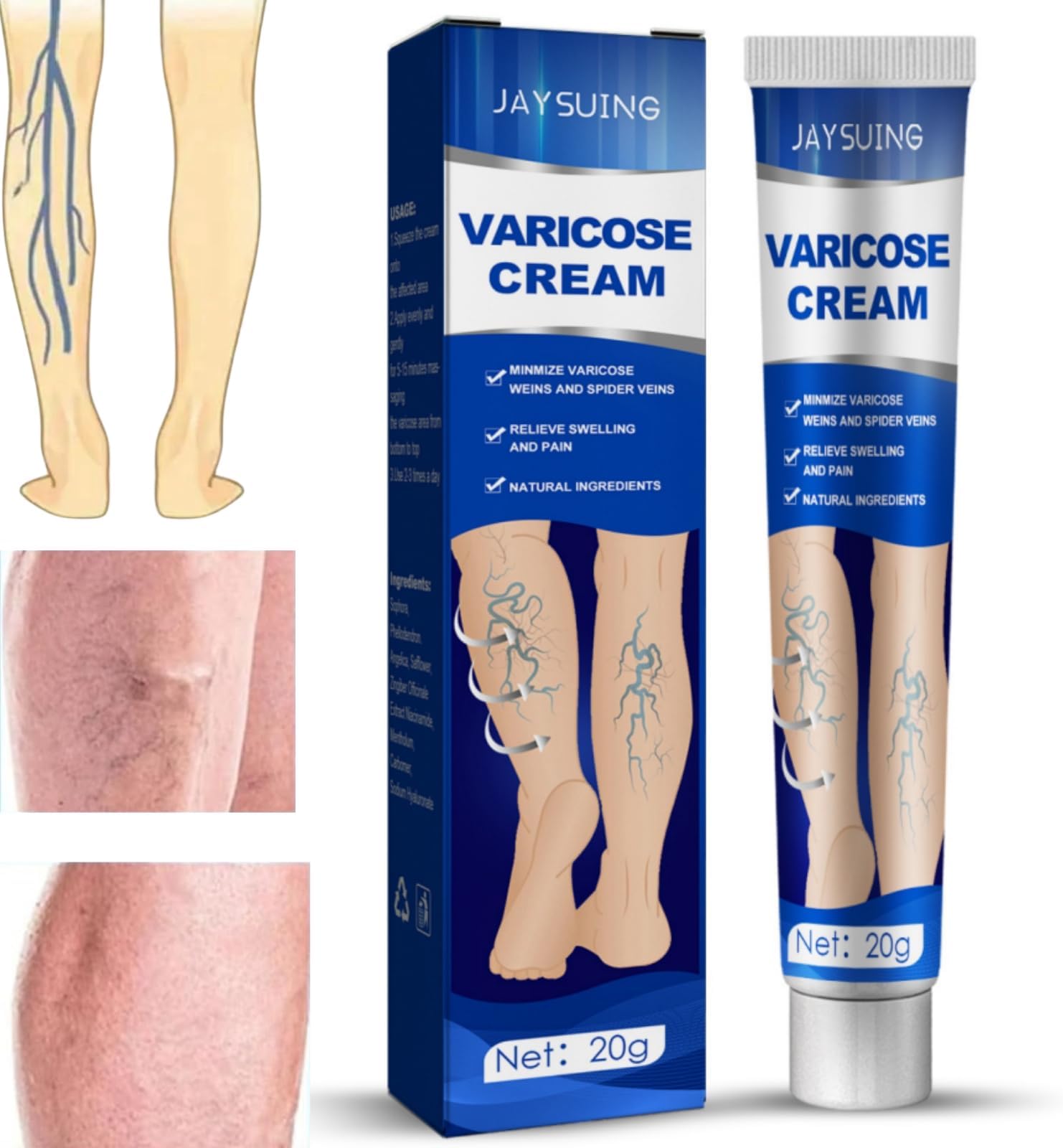 Varicose Veins Cream,Varicose Veins Treatment for Leg,Spider Vein Cream Relief,Vein Healing Varicose Veins Treatment,Spider Veins Treatment,Aricose Veins Ointment,Therapy Cream for Varicose and Spider